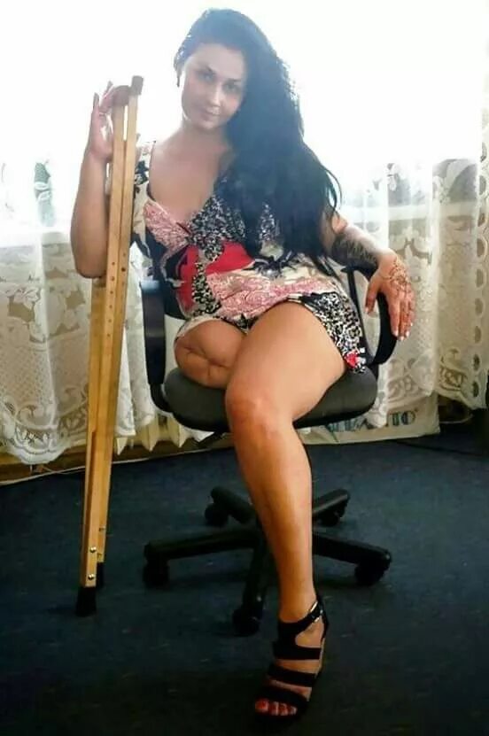 Девушка ампути без ног. Женщины с ампутацией бедра. девушка с высокой ампутацией бедер. женщины ампути русские.