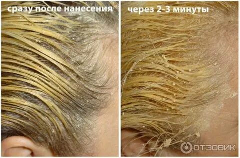 После бел