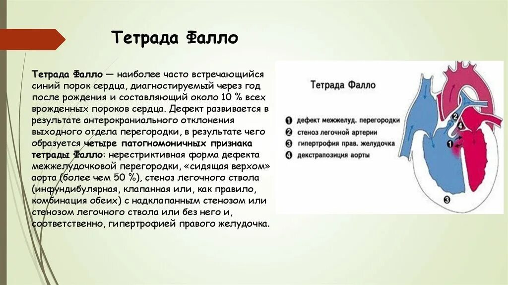 Наиболее часто встречающиеся пороки сердца. Диагностические критерии тетрады фалло. наиболее часто встречающийся врожденный порок сердца:. тетрада фалло порок сердца.