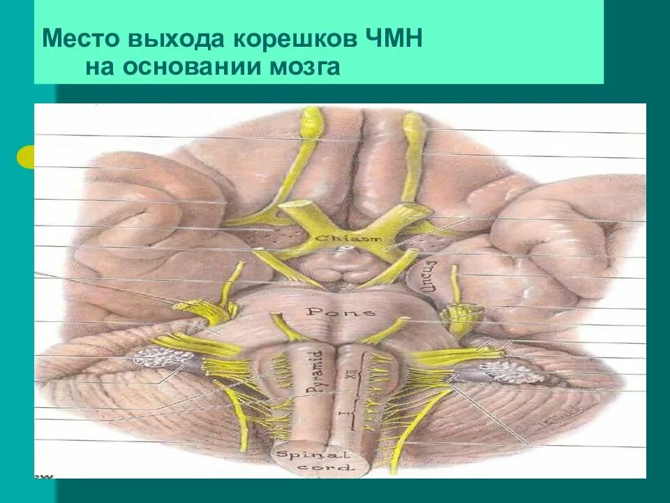 Корешки черепных нервов. Место выхода Корешков ЧМН. Корешки черепно-мозговых нервов. Черепно мозговые нервы топографическая анатомия. Черепные нервы корешки.