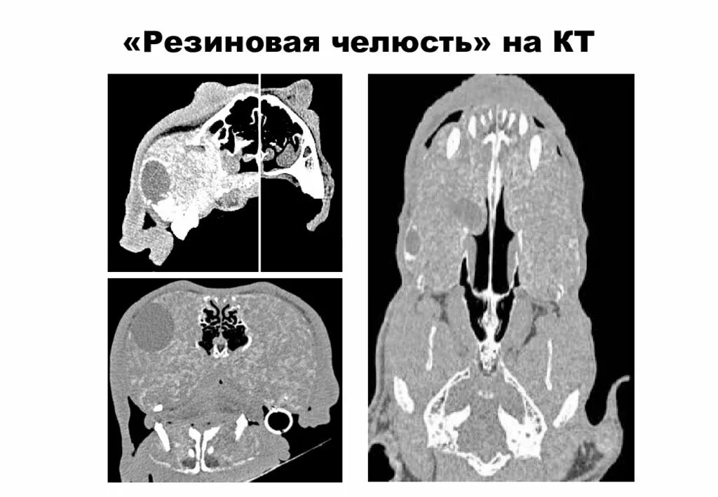 Череп на кт. Кт компьютерная томография черепа. компьютерная томография лицевого отдела черепа. компьютерная томограмма лицевого отдела черепа. кт лицевого отдела черепа.