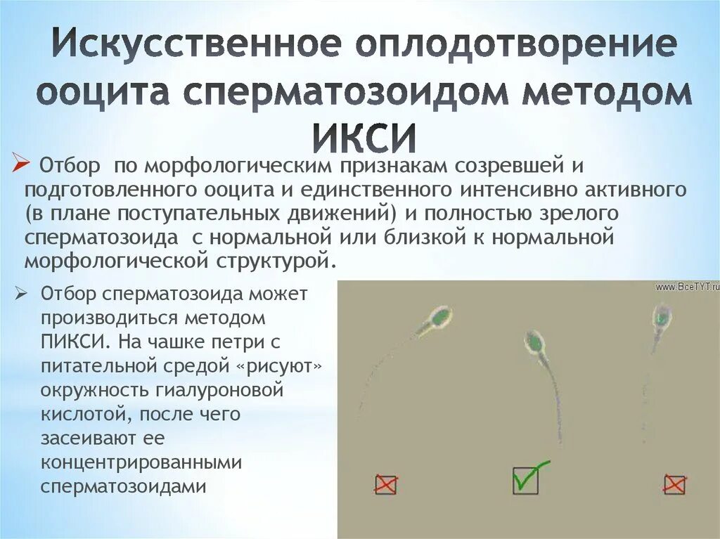 Метод искусственной инсеминации. Искусстсвенноеоплодотворение. Методика экстракорпорального оплодотворения. Методы искусственного оплодотворения.