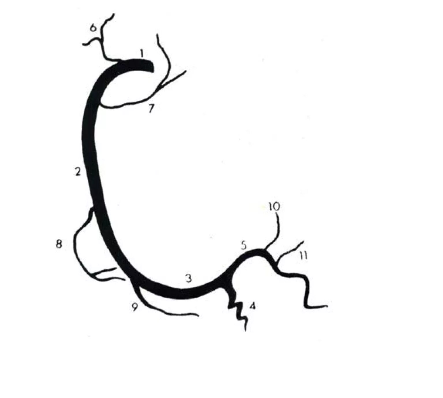 Пна 2. Пна 2. Пна 2. Синус 2пи/3 таблица. Схема левой коронарной артерии.