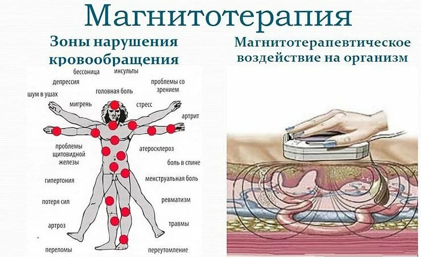 Воздействие на кровообращение. Магнитотерапия в физиотерапии показания. Магнит терапия аппарат противопоказания. Воздействие магнитотерапии. Физиотерапия магнит.