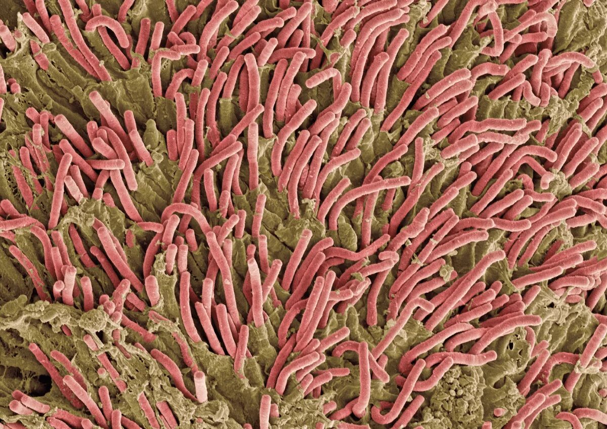 Fusobacterium spp. Fusobacterium spp