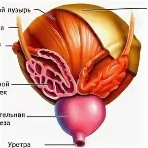 Везикулит симптомы и лечение у мужчин. Семенные пузырьки везикулит. Воспаление семенных пузырьков у мужчин симптомы. Застой в семенных пузырьках.