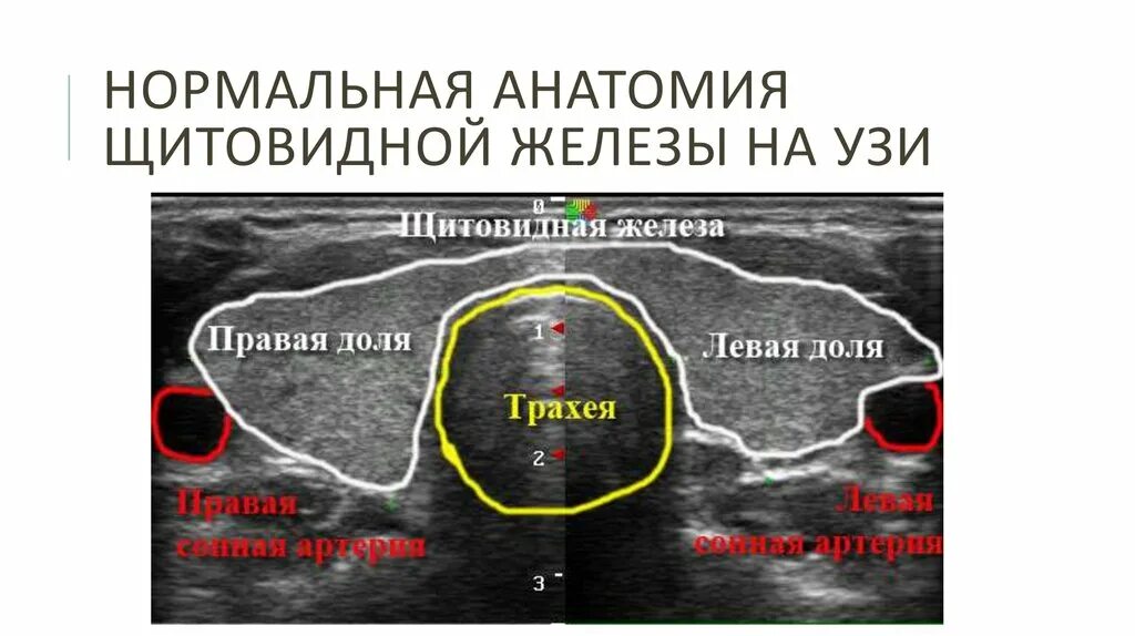 Анатомия уз. Узи предстательной железы изранов. Анатомия щитовидной железы на узи. Анатомия уз. Узи гепатобилиарной зоны.