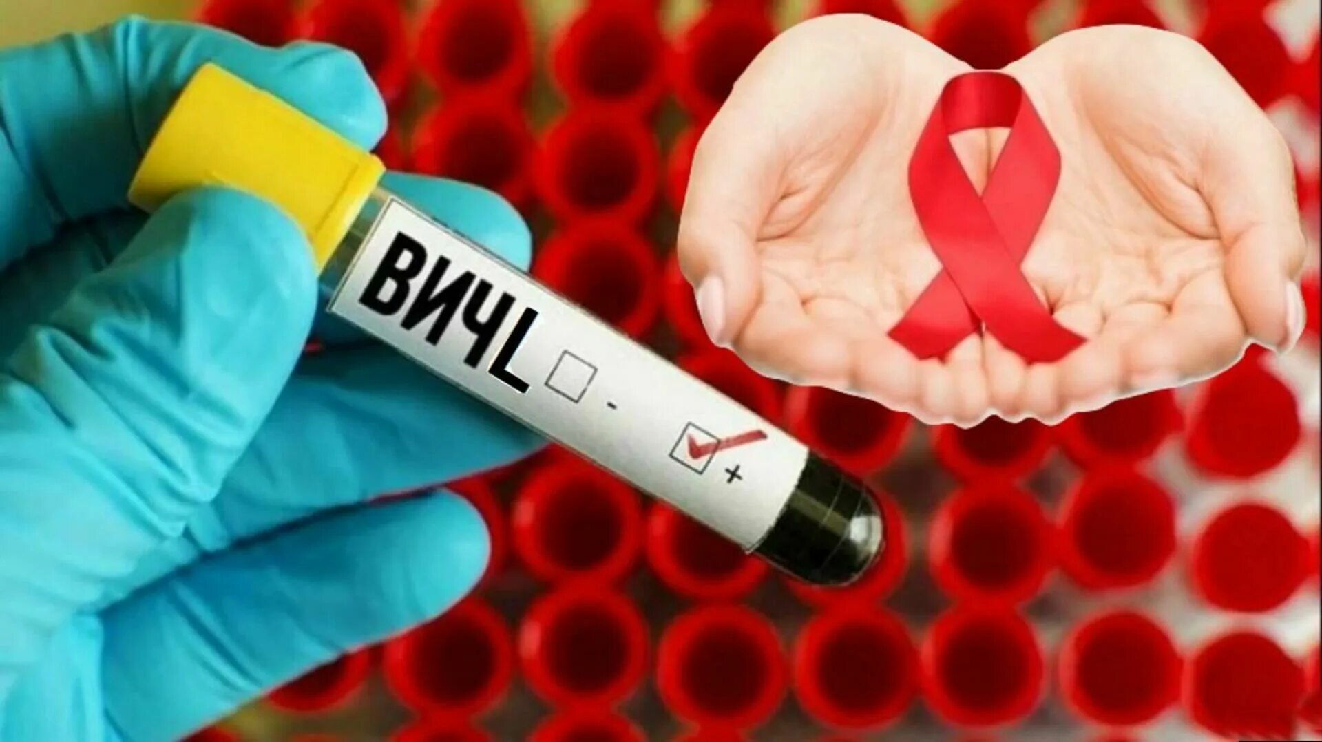 Вич hiv