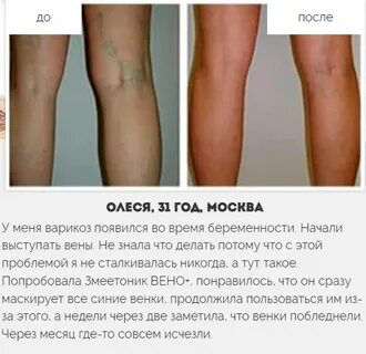Змеетоник плюс
