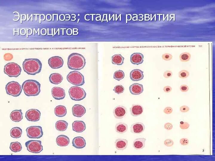 Стадии эритропоэза