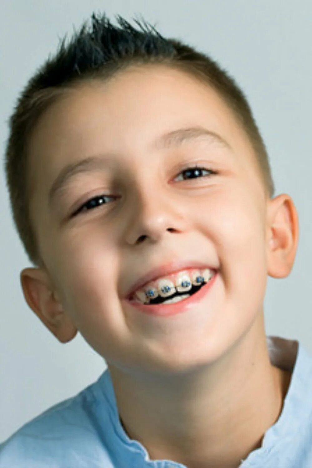 ребенок 9 лет передние зубы