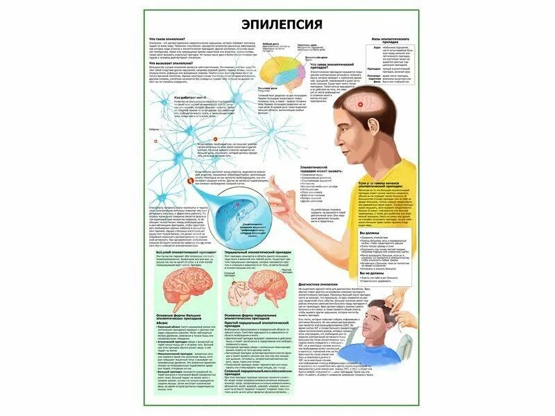 Пройти обследование эпилепсии. Плакат эпилепсия. профилактика эпилепсии. эпилепсия памятка. памятка эпилепсия для пациента.