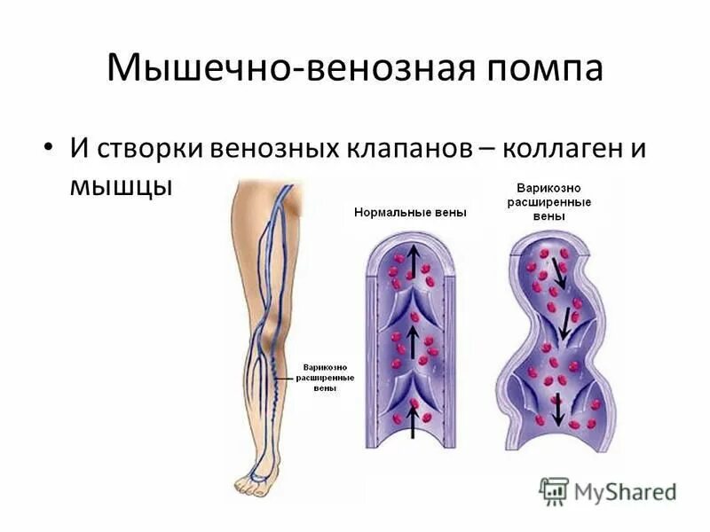 венознo мышечные насосы. клапанно-венозная мышца. венознo мышечные насосы. венозные клапаны нижних конечностей человека. мышечно венозная помпа голени.