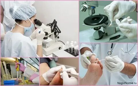 Сдать соскоб ногтей
