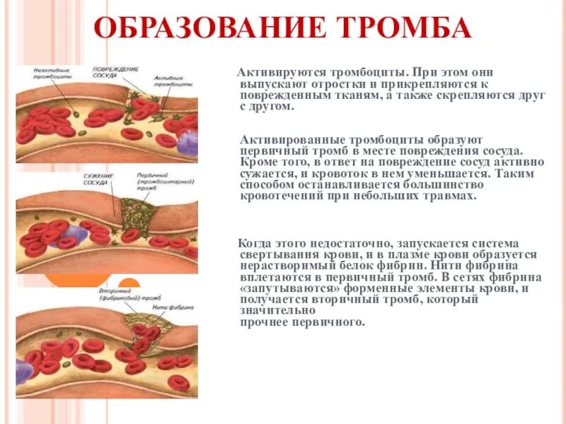 Почему у человека образуется в. Схема образования тромбоцитарного тромба. Тромбоциты крови тромб образование. Процесс образования тромба в крови. Формирование кровяного сгустка.