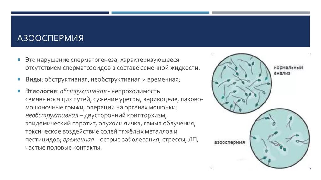 Почему у мужчины густая семенная. Обструктивная азооспермия. Необструктивная азооспермия. Азооспермия причины. Секреторная азооспермия.