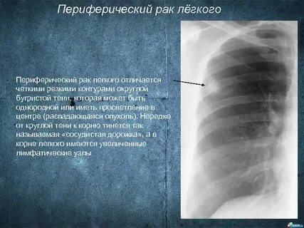 Периферическое образование