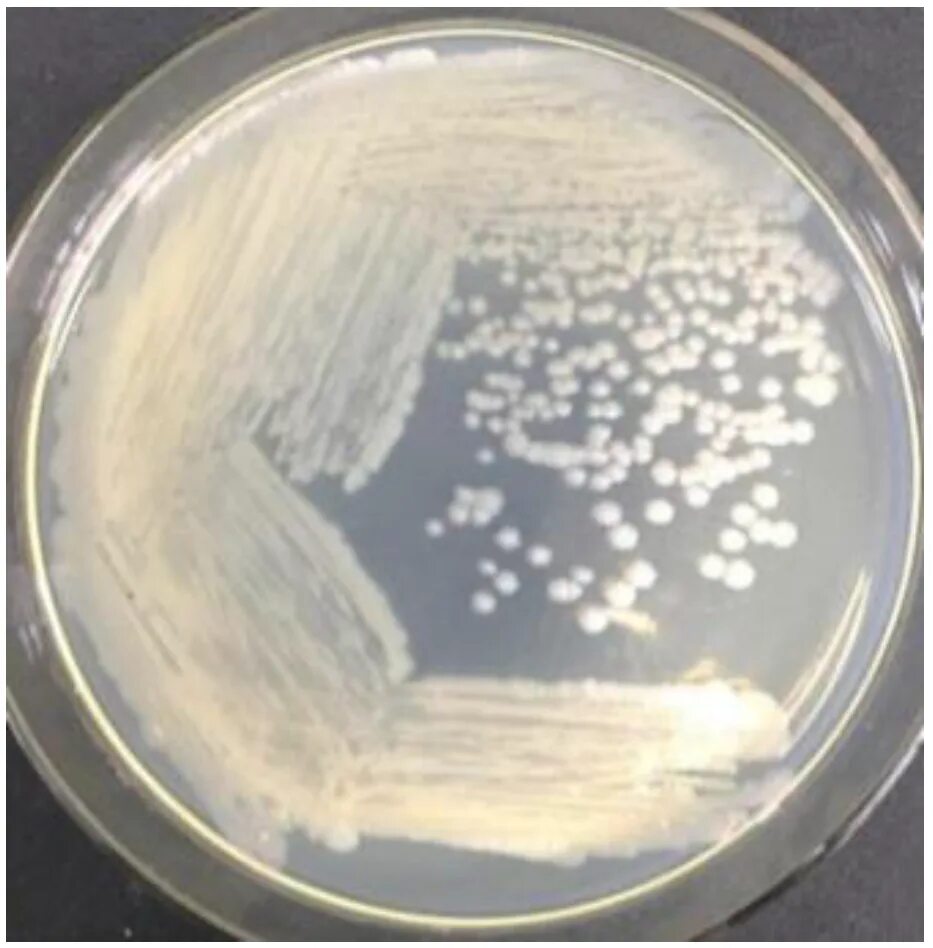 Bacillus subtilis что это. Bacillus licheniformis колонии. bacillus subtilis natto. бациллюс субтилис. зараженность bacillus subtilis.