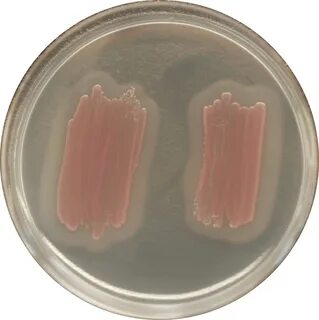 Методы выявления бактерий listeria monocytogenes