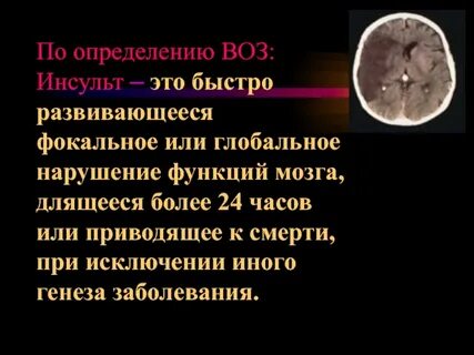 Инсульт определение