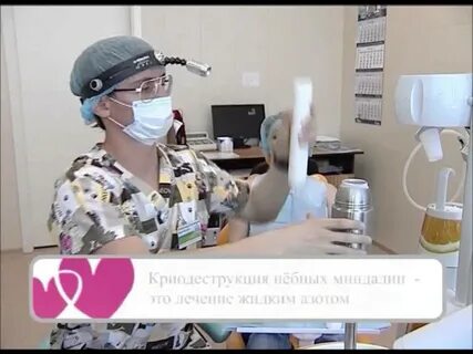 Криотерапия миндалин отзывы