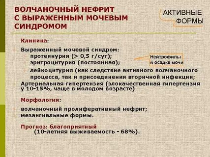 Нефрит анализ мочи