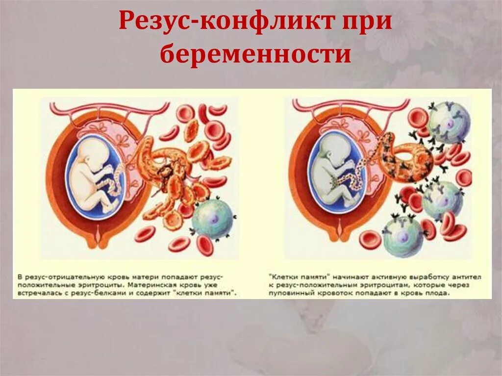 Первая положительная беременность. Резус-конфликт при беременности препараты. Резус-конфликт при беременности матери и плода. Клинические проявления резус конфликта. Резус конфликт схема.