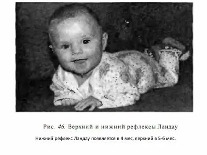 Рефлекс ландау
