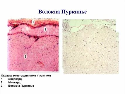 Сердечный система гистология
