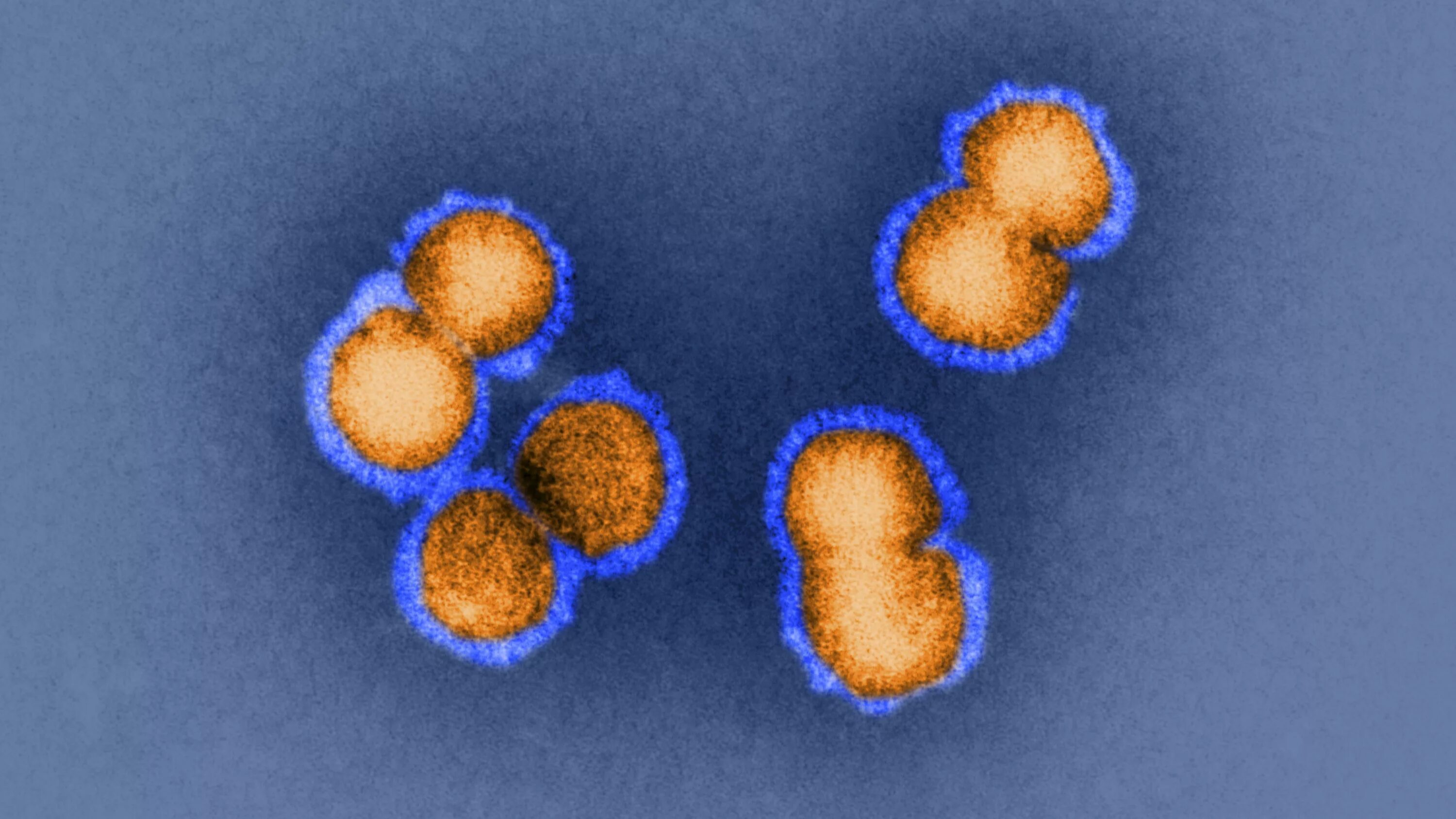 Грипп б 1. Вирус h5n1. Вирус гриппа под микроскопом h1n1. Influenza a virus h5n1. H5n1.