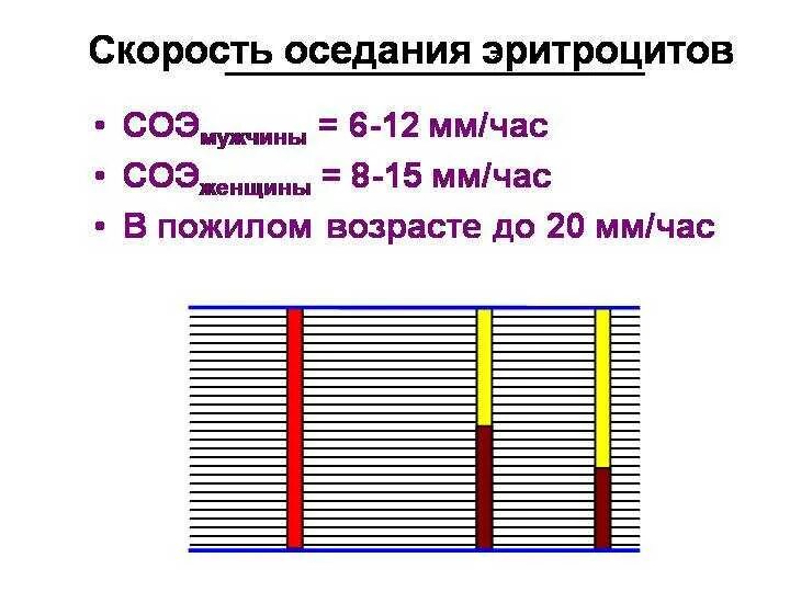 Соэ 37 у женщины что