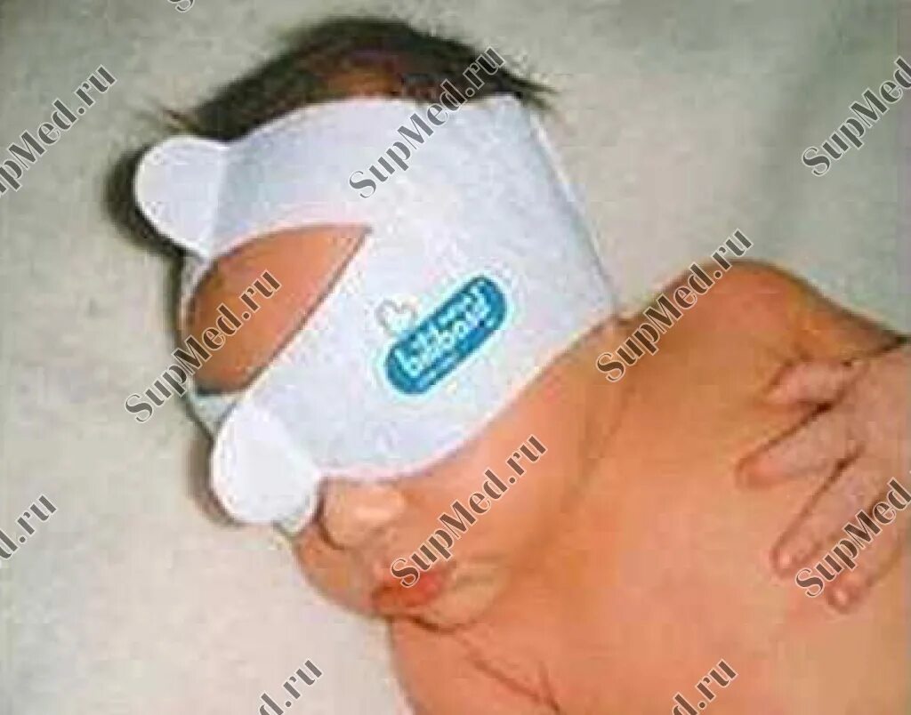 Очки для фототерапии новорожденных covidien. Очки для фототерапии для новорожденного natus billiband. Очки–глазные протекторы для фототерапии новорожденных philips. Повязка для фототерапии. Очки для новорожденных для лампы от желтушки.