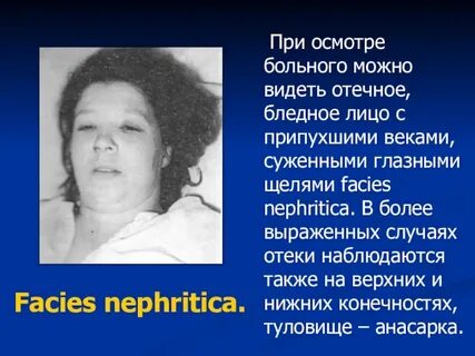 И кажется лицо бледней