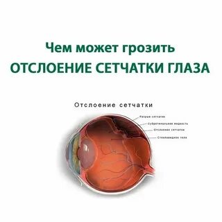 Отслойка сетчатки клинические рекомендации