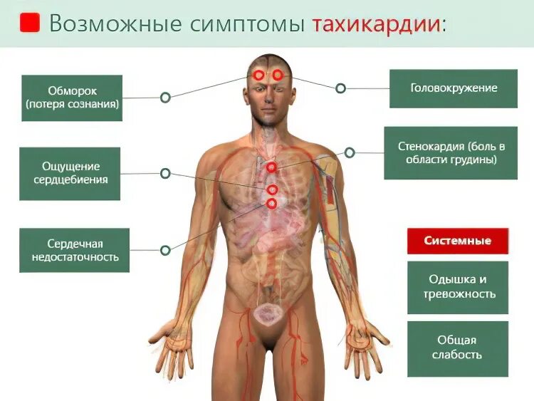 Высокий пульс судороги