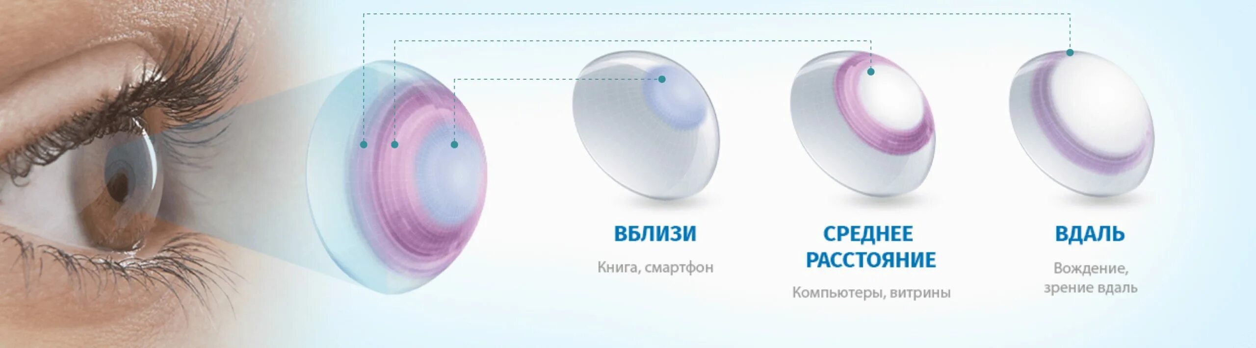 Линза у которой края толще. Мультифокальные линзы Alcon Multifocal. Контактные линзы Dailies total1® Multifocal. Dailies total 1 Multifocal. Строение мультифокальной линзы.