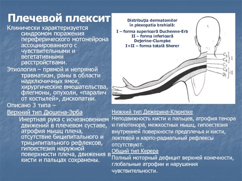 Поражение плечевого сплетения неврология. Травматический плексит плечевого сплетения Дюшенна-Эрба. Верхний плексит плечевого сплетения. Плексопатия плечевого нерва.