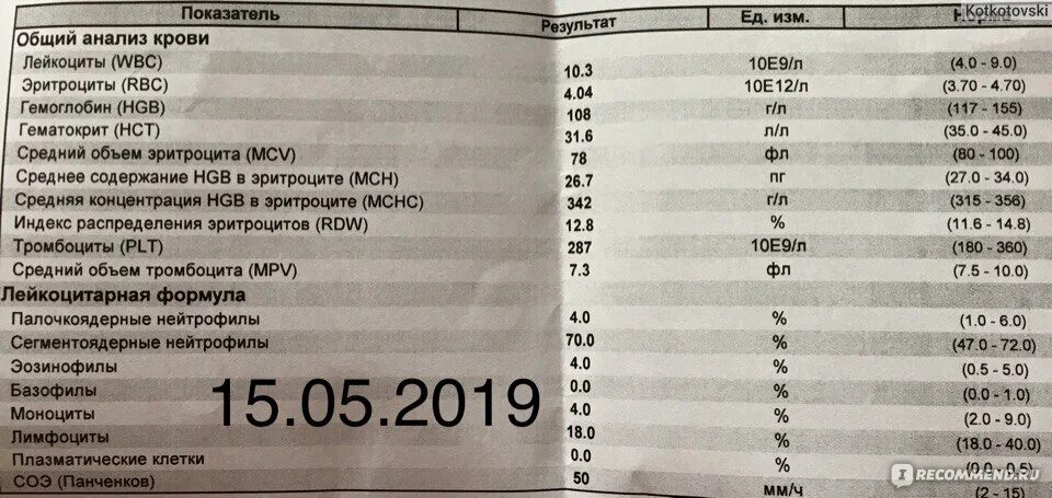 Rdw в анализе крови. RDW-SD В анализе крови норма. Показатели крови RDW что это. Клинический анализ крови RDW CV.