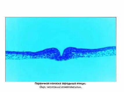 Первичная полоска зародыша
