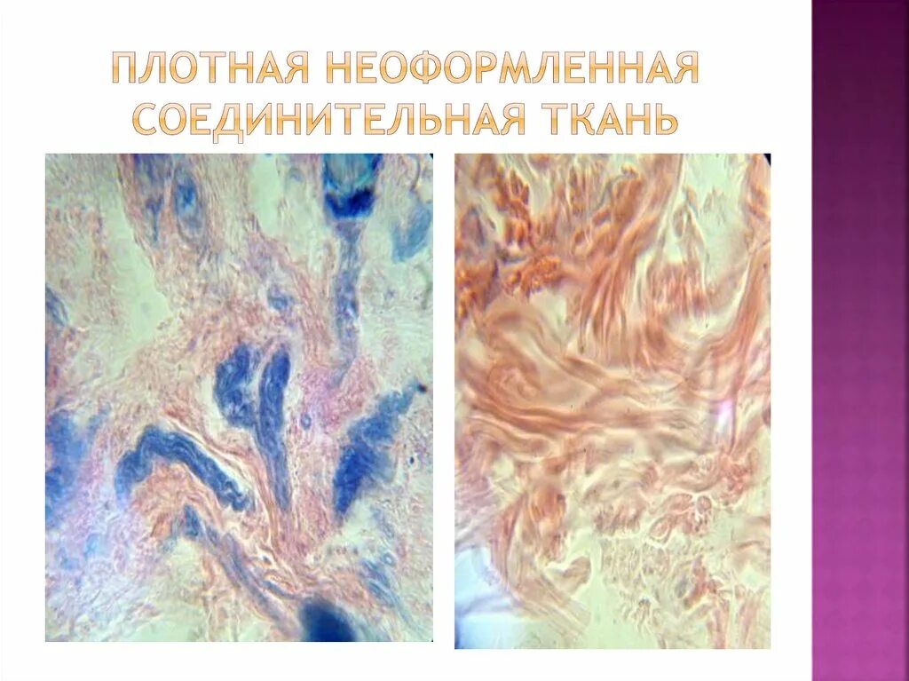 Рыхлая плотная неоформленная соединительная ткань. Рыхлая плотная неоформленная соединительная ткань