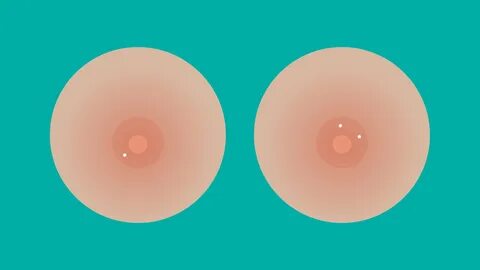 white spot on nipple not breastfeeding - www.ai-rising.com.