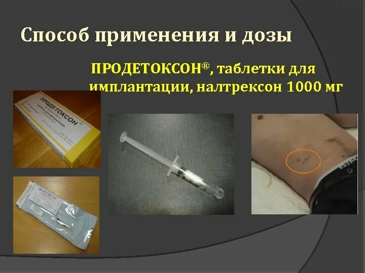 Рекомендация после имплантации зуба. Антибиотики после имплантации. Рекомендации пациенту после имплантации. Относительные противопоказания к дентальной имплантации. Антибиотик при вырывании зуба.