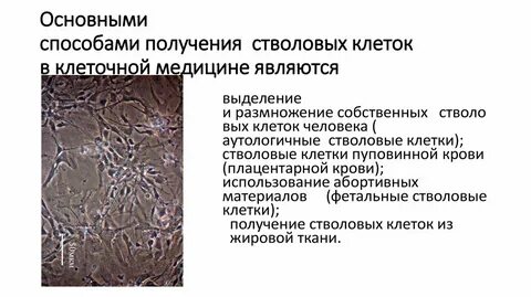 Метод стволовых клеток