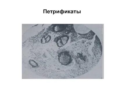 Петрификат