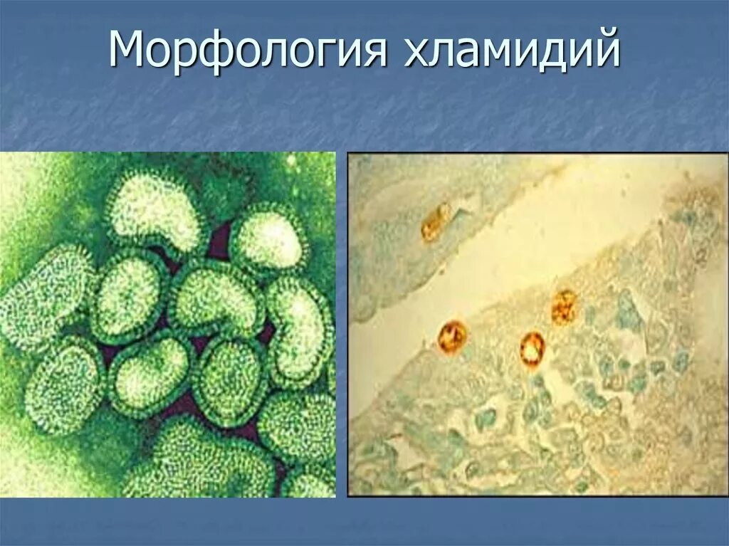 Chlamydia trachomatis. Морфология хламидии трахоматис. Хламидии морфология микробиология. Хламидии строение микробиология. Морфология хламидий микробиология.