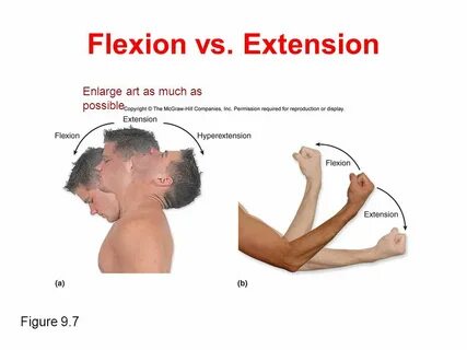 V extension