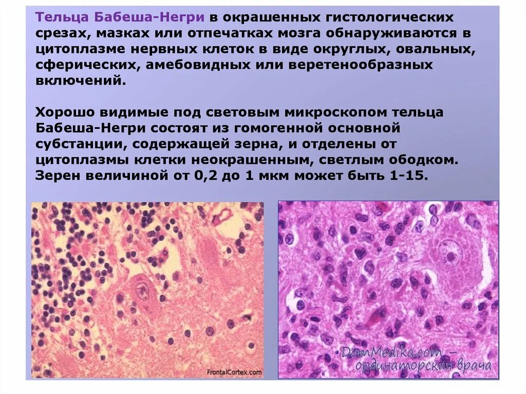 Многочисленные мелкие тельца. Тельца Бабеша негри микробиология. Тельца Бабеша негри микропрепарат. Обнаружение Телец Бабеша-негри.