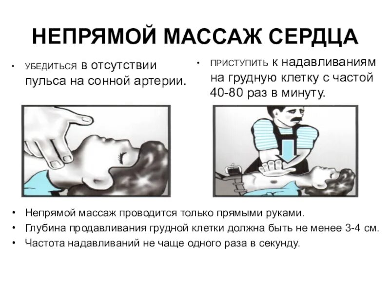 Непрямой массаж сердца глубина продавливания грудной клетки. Частота нажатий на грудную клетку при непрямом массаже сердца. Частота надавливаний при непрямом массаже сердца. Непрямой массаж сердца частота нажатия в минуту. Непрямой массаж сердца частота надавливаний