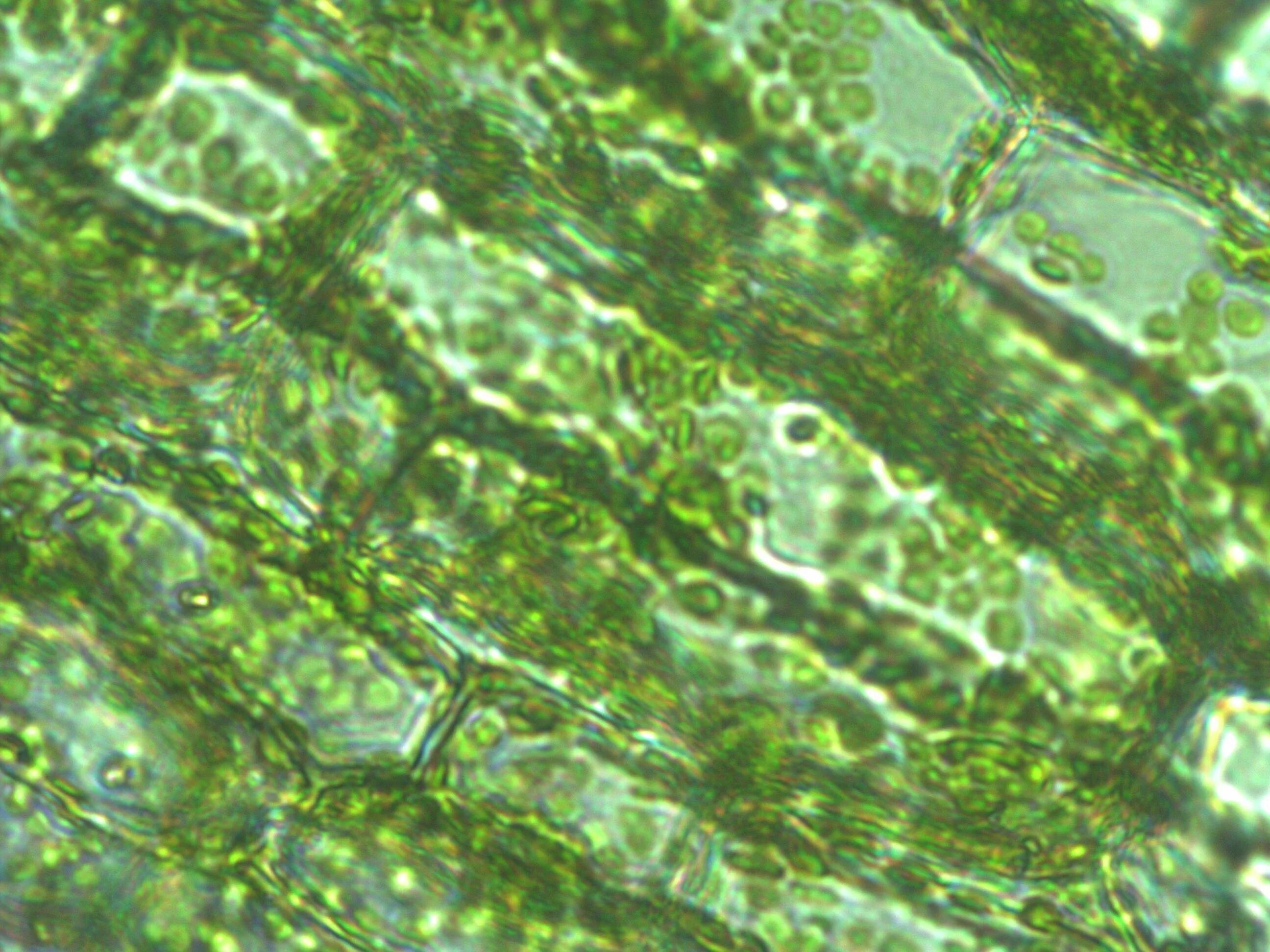 Хлоропласты зеленых водорослей. Клетки листа элодеи под микроскопом. Клетка элодеи под микроскопом. Элодея микроскоп. Хлоропласты в клетках листа элодеи.