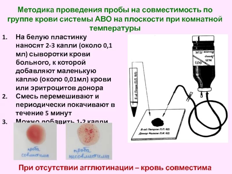 Проба на совместимость по резус фактору